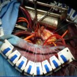 Organizadores de sutura Snake